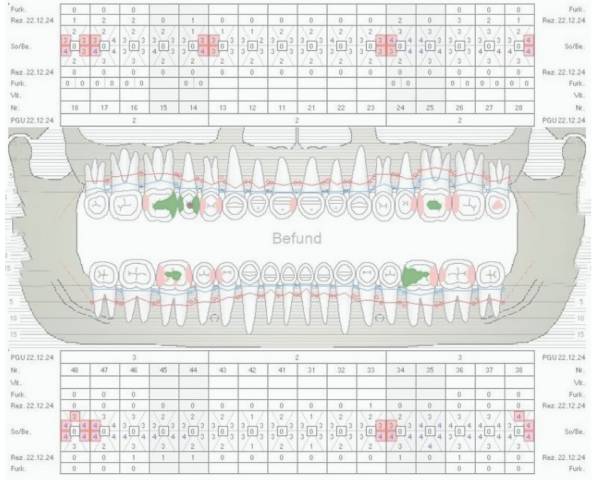 Situation sechs Monate nach dem Wechsel zu Meridol Parodont Expert Produkten