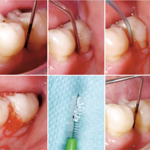 Allgemeines Bild von Zahnpasta